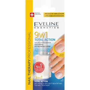 Eveline 9in1 Total Action Concentrated Toenail Conditioner Anti-Ridge & Discolorations 12ml
